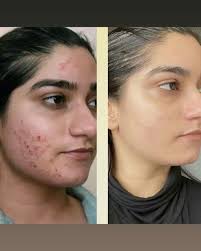 Zafrani Organic Cream (Beauty Cream)